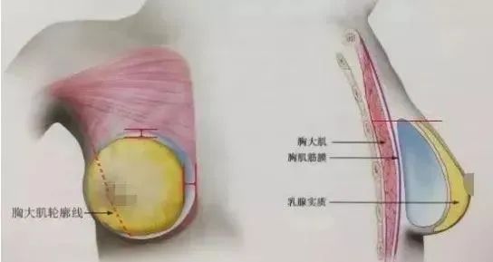 哪个年龄段适合做假体隆胸?如何才能大的自然?do胸前先看这一篇! 图片-6