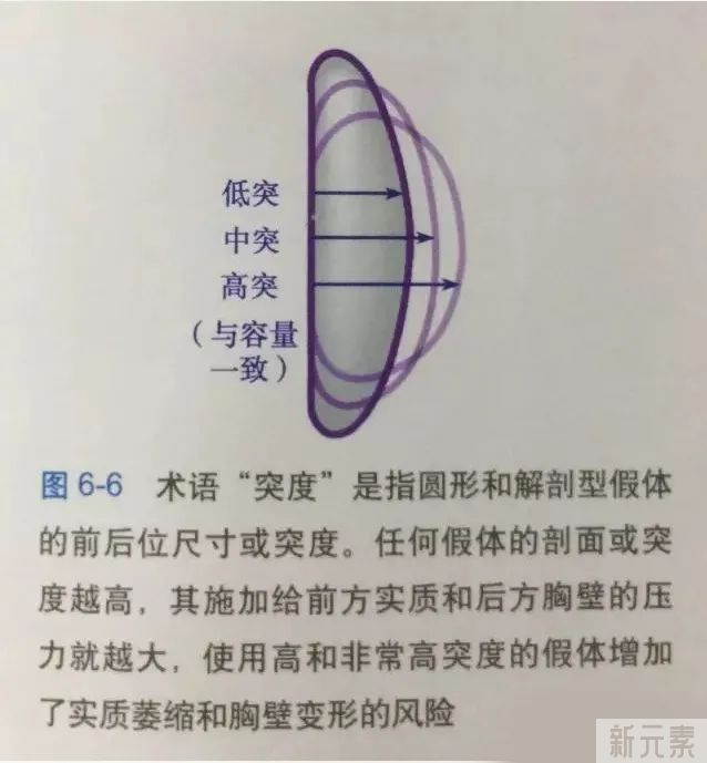 假体隆胸 | 水滴形和圆形假体该怎么选择? 图片-6
