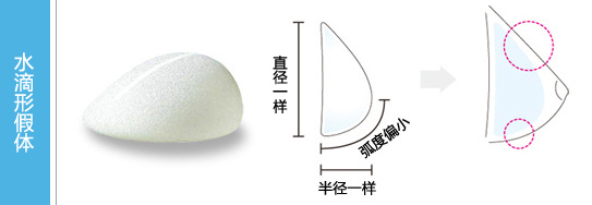 假体隆胸 | 水滴形和圆形假体该怎么选择? 图片-4