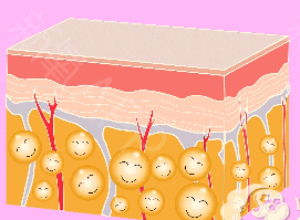 想要切除副乳又怕痛?你还可以选择—— 图片-8