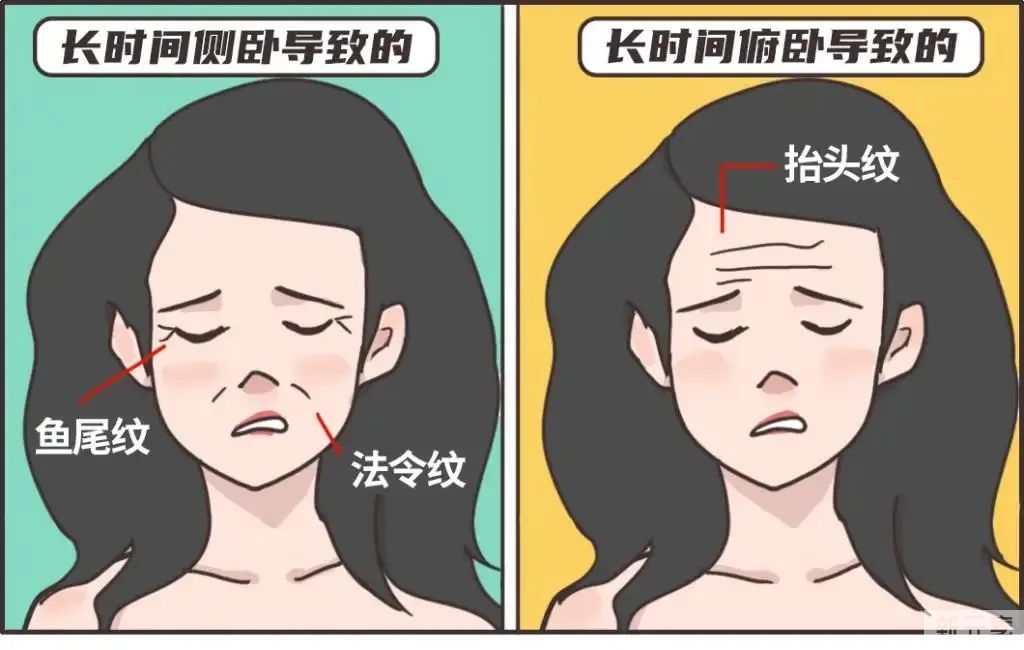 长期侧睡真的会加深法令纹吗? 图片-2