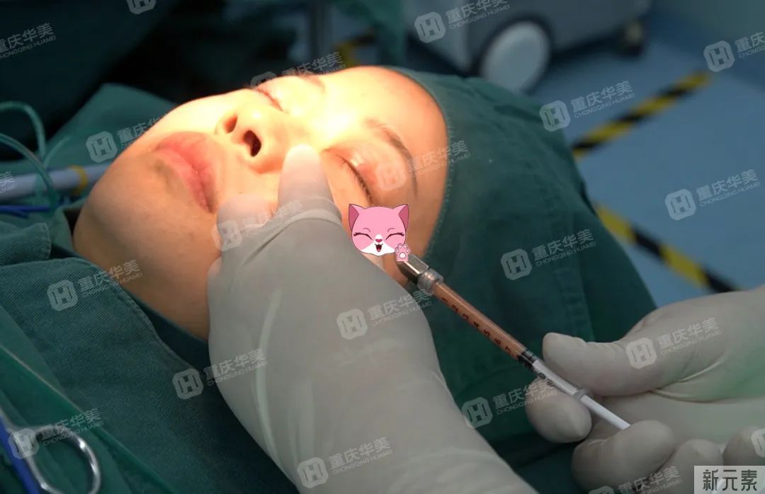 有这4种情况还不祛眼袋，再祛就难了，治疗费还得翻倍! 图片-9