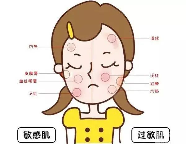 盘点那些敏感肌也能做的医美项目 图片-15