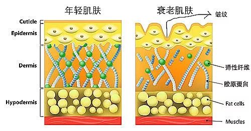 超声炮、Fotona 4D Pro、热玛吉，抗衰怎么选? 图片-3