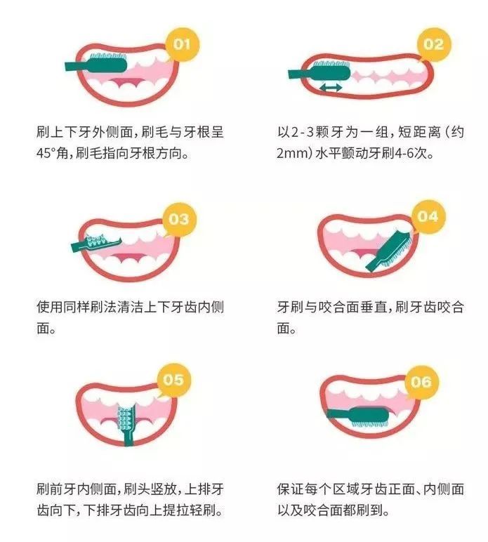为什么天天按时刷牙，还是会有蛀牙? 图片-8