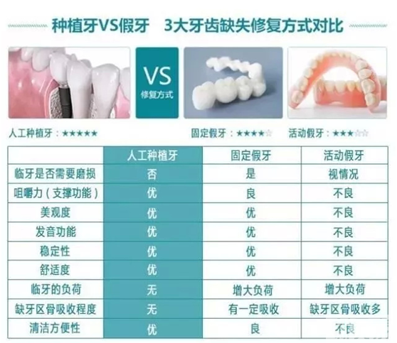 聊医聊 | 牙齿松动了，拔还是不拔? 图片-9