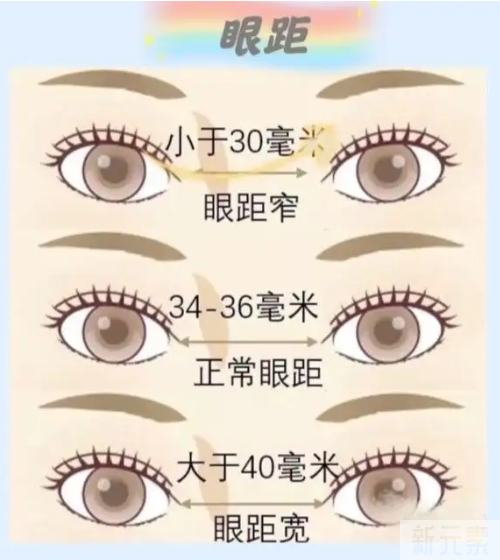 什么情况适合做开内眼角手术? 图片-7