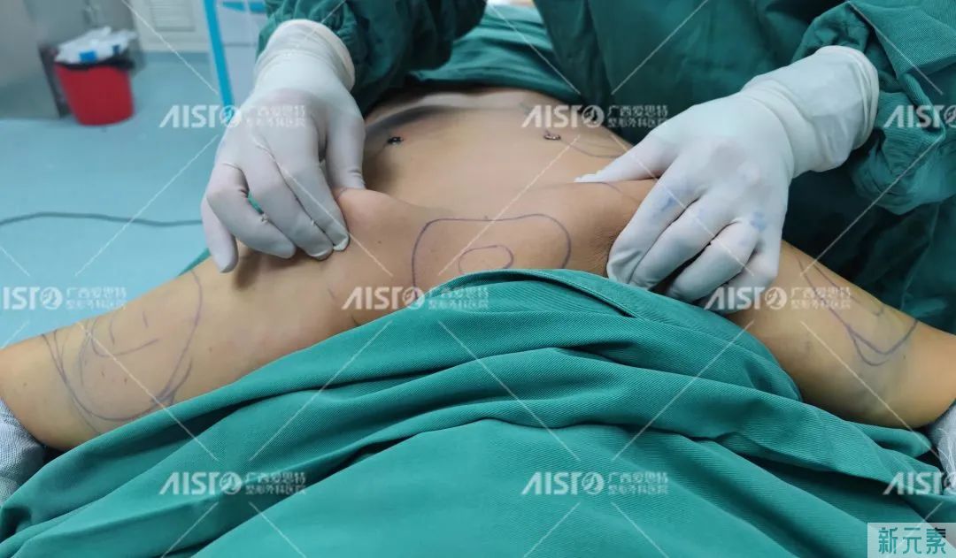 如何有效消除“富贵包”，选对方法很重要 图片-8