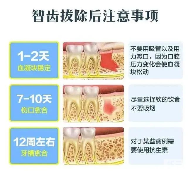 拔完牙后，该怎么刷牙呢?牙窟窿又是如何愈合的? 图片-3