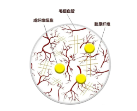 疤痕修复时，常见的6大问题，建议收藏! 图片-6