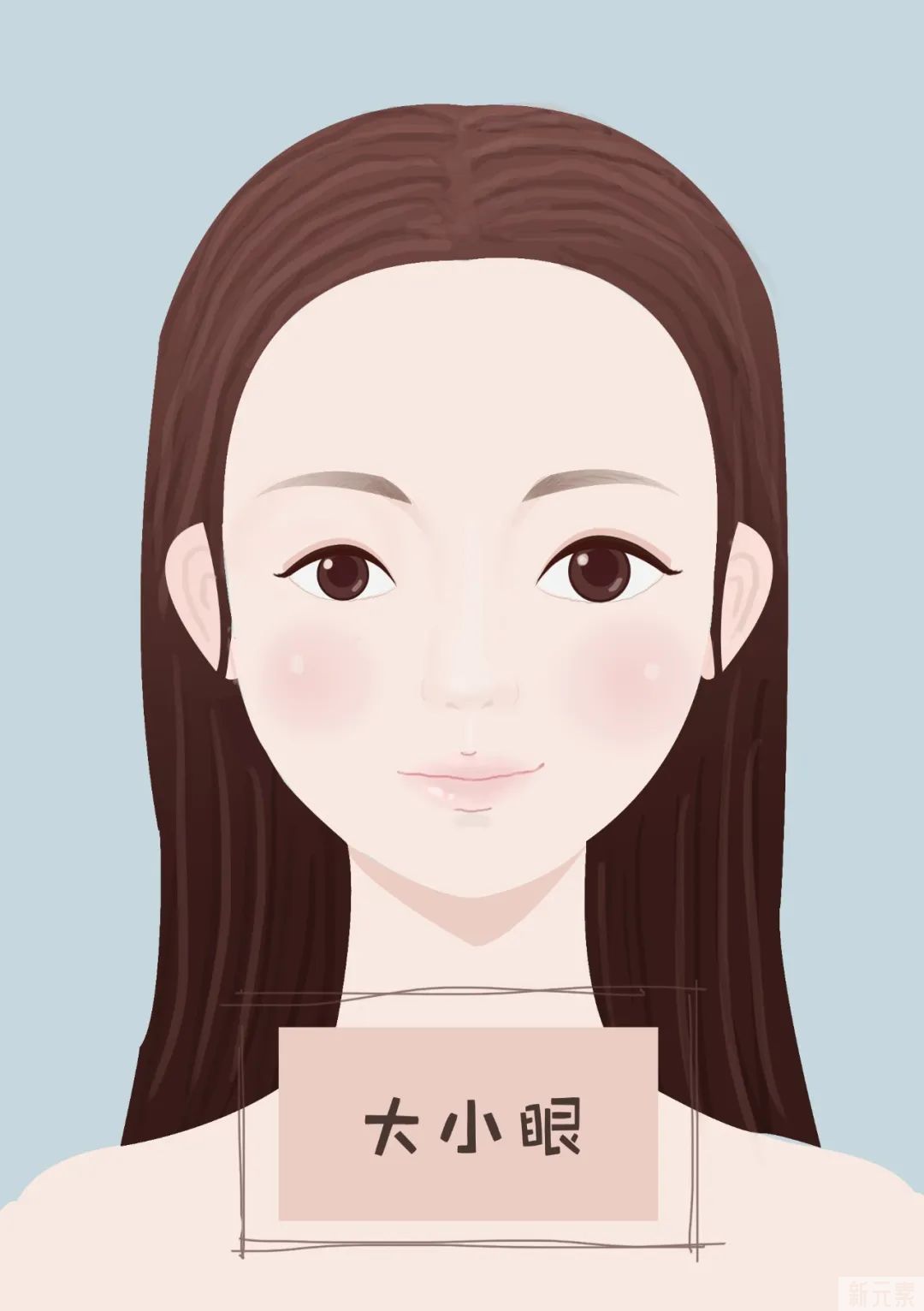 整形无小事丨埋线双眼皮，为什么选择的人变少了? 图片-4