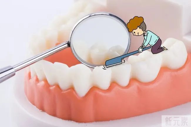 牙周炎可怕吗?不疼却一直在侵蚀牙齿?! 图片-6