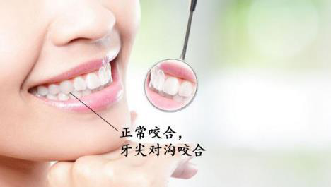 为什么矫正要拔牙，拔牙会留缝么? 图片-22