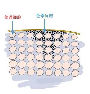 激光“反黑”是必然的吗?怎么办? 图片-2