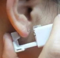 【打耳洞必看】打耳洞出现疤痕疙瘩，与这三个原因有很大关系! 图片-4