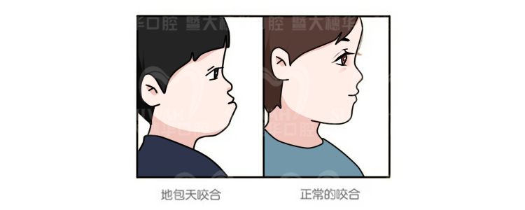 为什么别人矫牙只用1年，而你却要2年? 图片-9