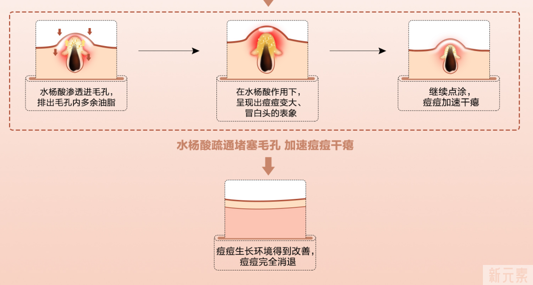 老痘没走，新痘又来?祛痘反复怎么办? 图片-7