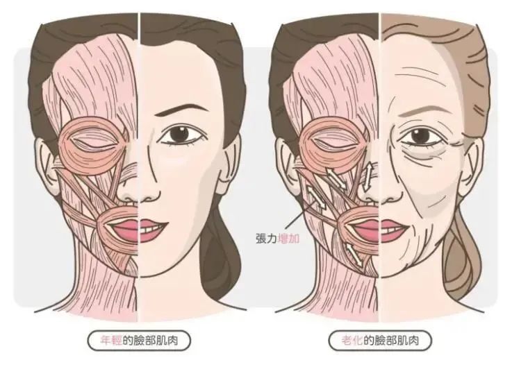 肉肉脸VS干瘪脸，抗衰方法你选对了吗? 图片-6