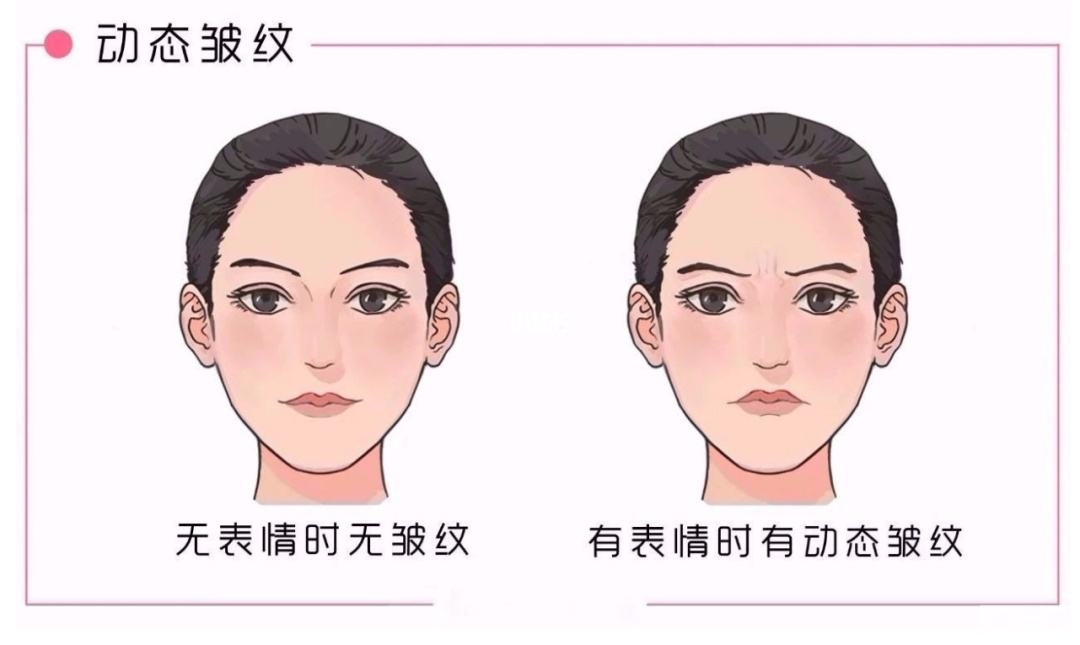 科普——眼周肌肤总是暗沉，怎么办? 图片-6