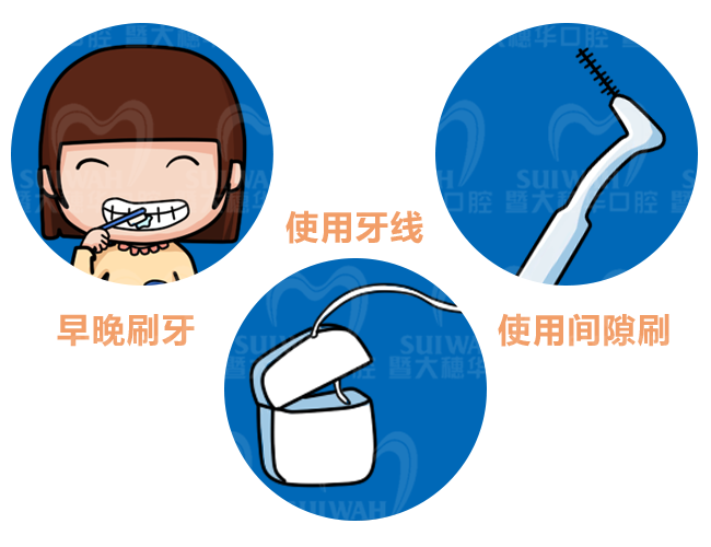 牙缝间容易蛀牙?教你3招有效预防! 图片-9