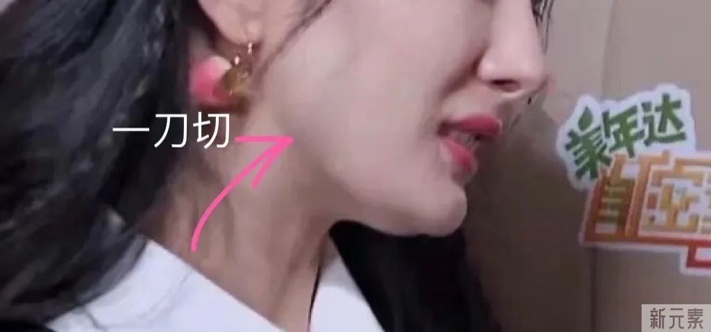 磨骨后一眼就能被识破?5个关于磨骨的误区，骗了多少人 图片-3