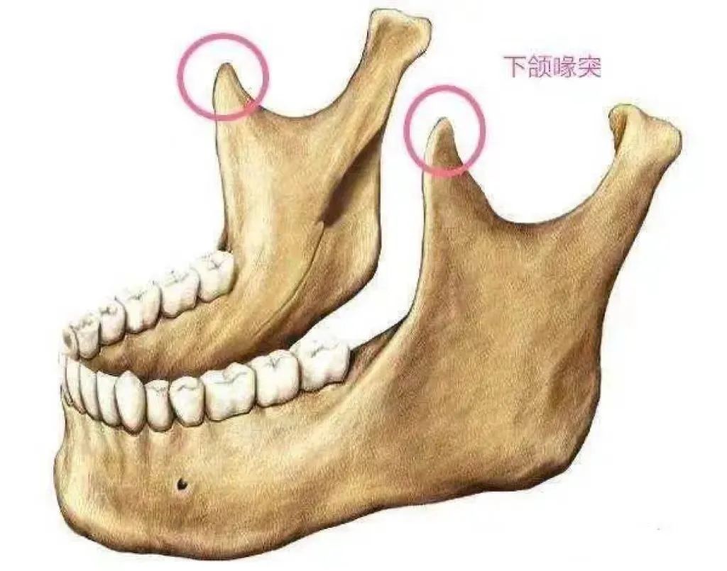 磨骨后一眼就能被识破?5个关于磨骨的误区，骗了多少人 图片-9