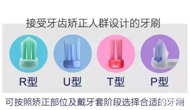 这事没做好，牙齿矫正的钱就白花了! 图片-4
