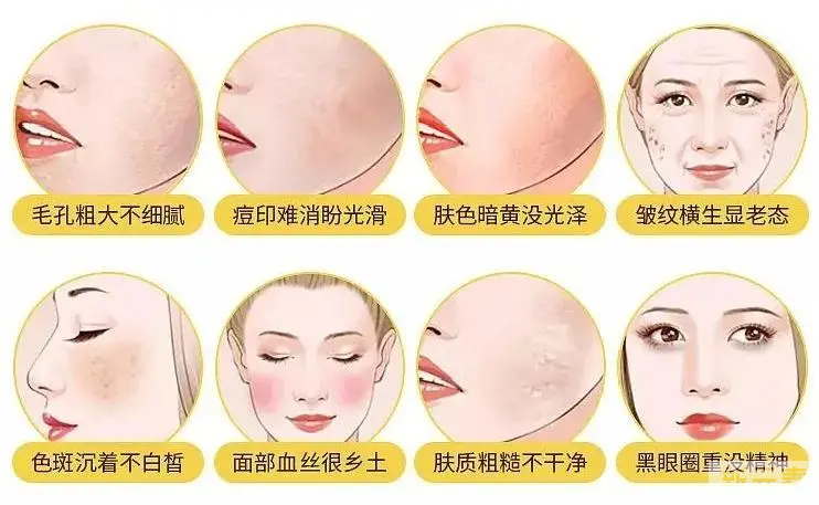 给你详细整理了最全——黑金超光子!!!还不赶紧码住收藏! 图片-6