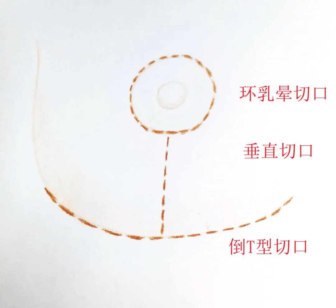 如何拯救乳房下垂 图片-9