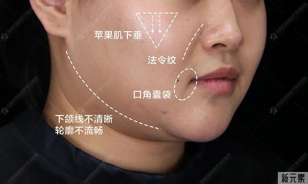 肉肉脸VS瘦瘦脸正确K老方式，可别选错了 图片-3