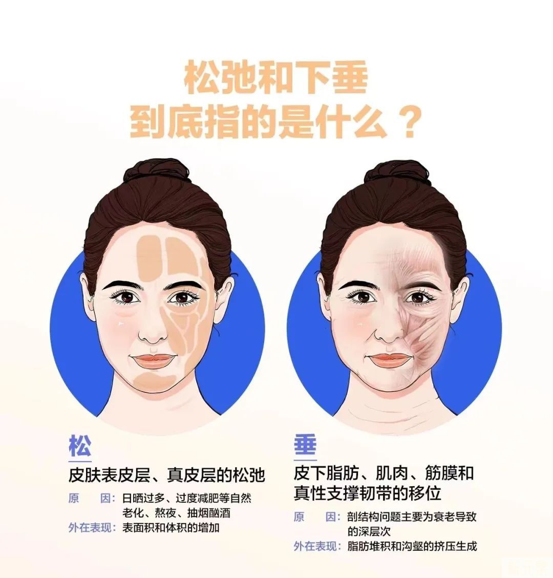 皮肤“松”和“垂”不是一回事!抗衰无效，是你思路不对! 图片-5