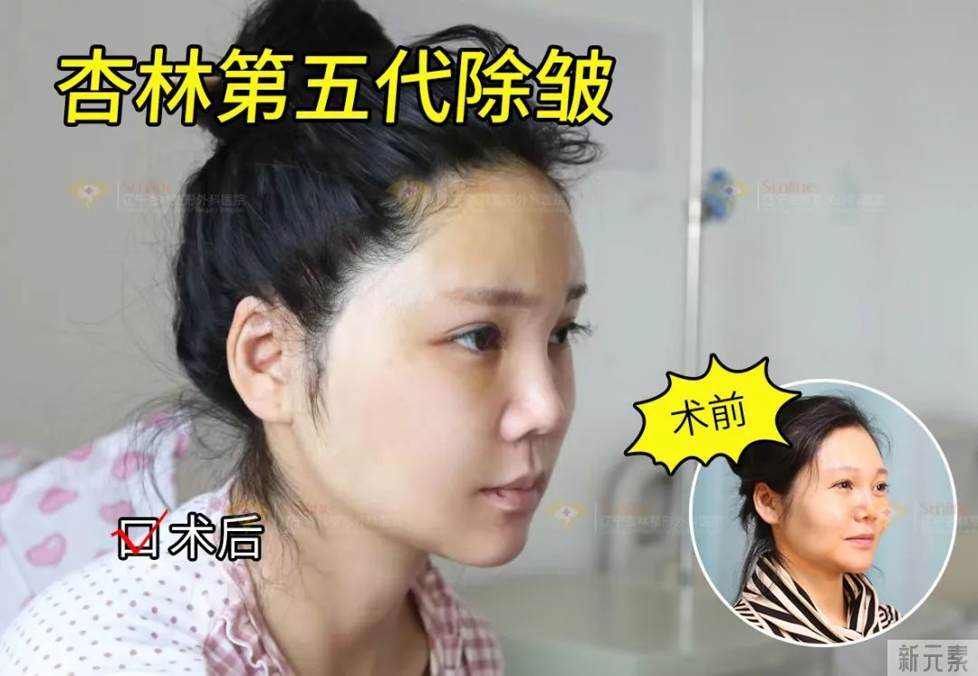 皮肤“松”和“垂”不是一回事!抗衰无效，是你思路不对! 图片-3