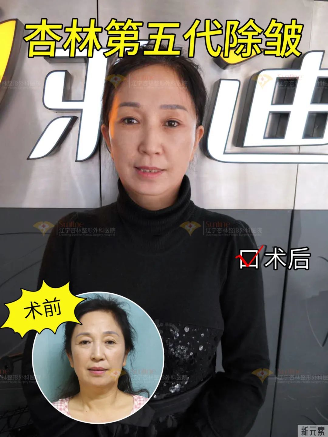皮肤“松”和“垂”不是一回事!抗衰无效，是你思路不对! 图片-8