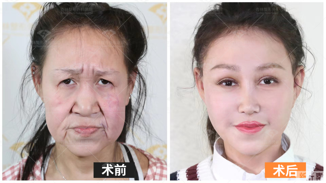 皮肤“松”和“垂”不是一回事!抗衰无效，是你思路不对! 图片-21