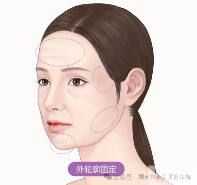 【轮廓固定】高定幼态脸，如何养成? 图片-2