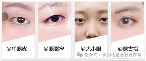 实现私人订制迷人电眼，攻略给你! 图片-1