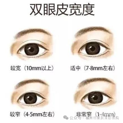 实现私人订制迷人电眼，攻略给你! 图片-5