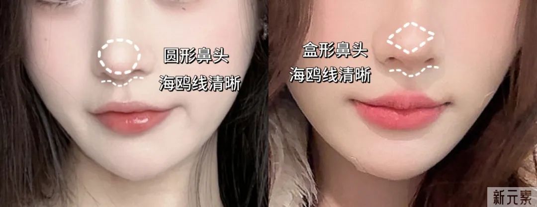 do鼻翻车的人，竟然80%都是因为这个部位... 图片-6
