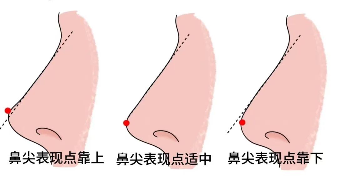 do鼻翻车的人，竟然80%都是因为这个部位... 图片-16