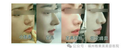 do鼻翻车的人，竟然80%都是因为这个部位... 图片-8