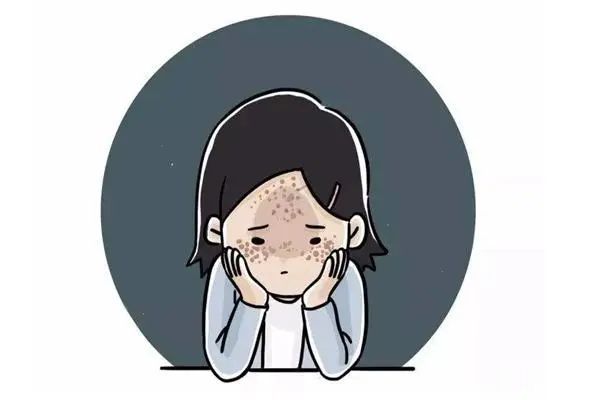 祛斑不要错过黄金期——实用的3种祛斑方法 图片-2