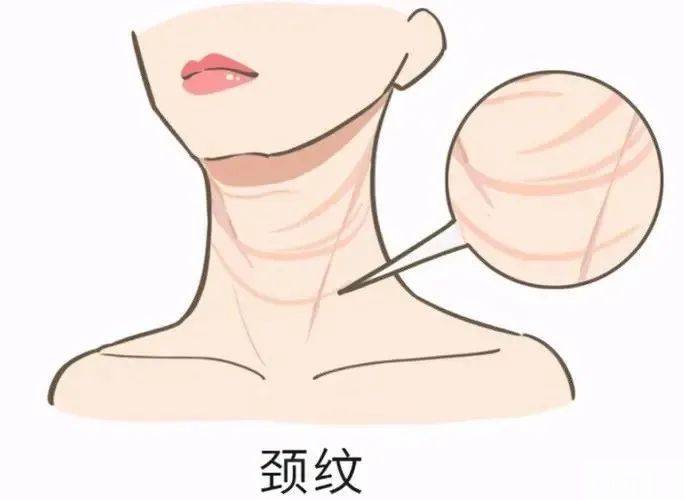 改善颈纹不仅只有嗨体,和这3个项目联合治疗效果更出众! 图片-2