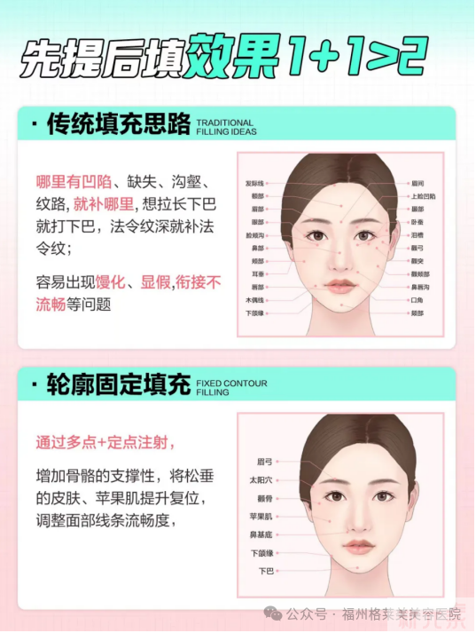 轮廓固定的正确打开方式!!! 图片-2