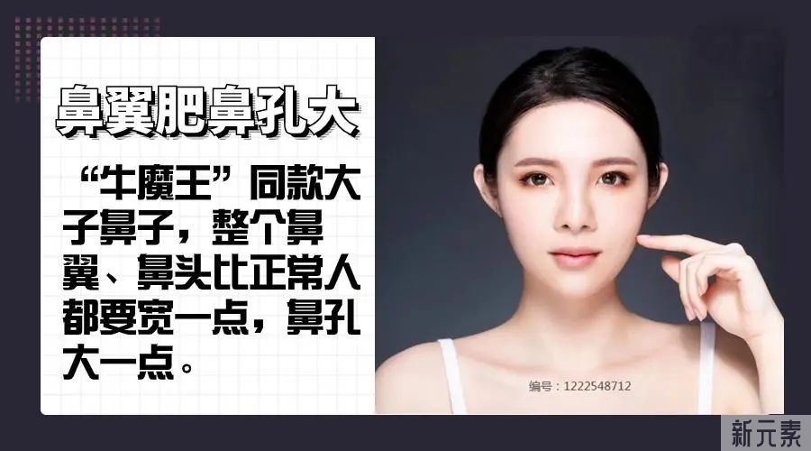 被叫猪猪侠?大鼻子、宽鼻翼如何颜值逆袭? 图片-11