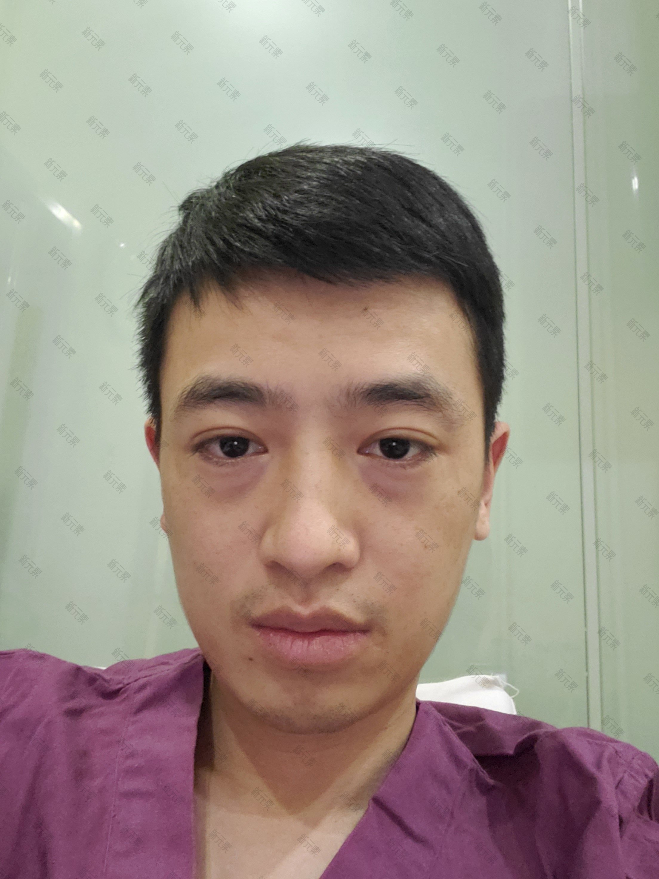 合肥凯婷美容医院李立国