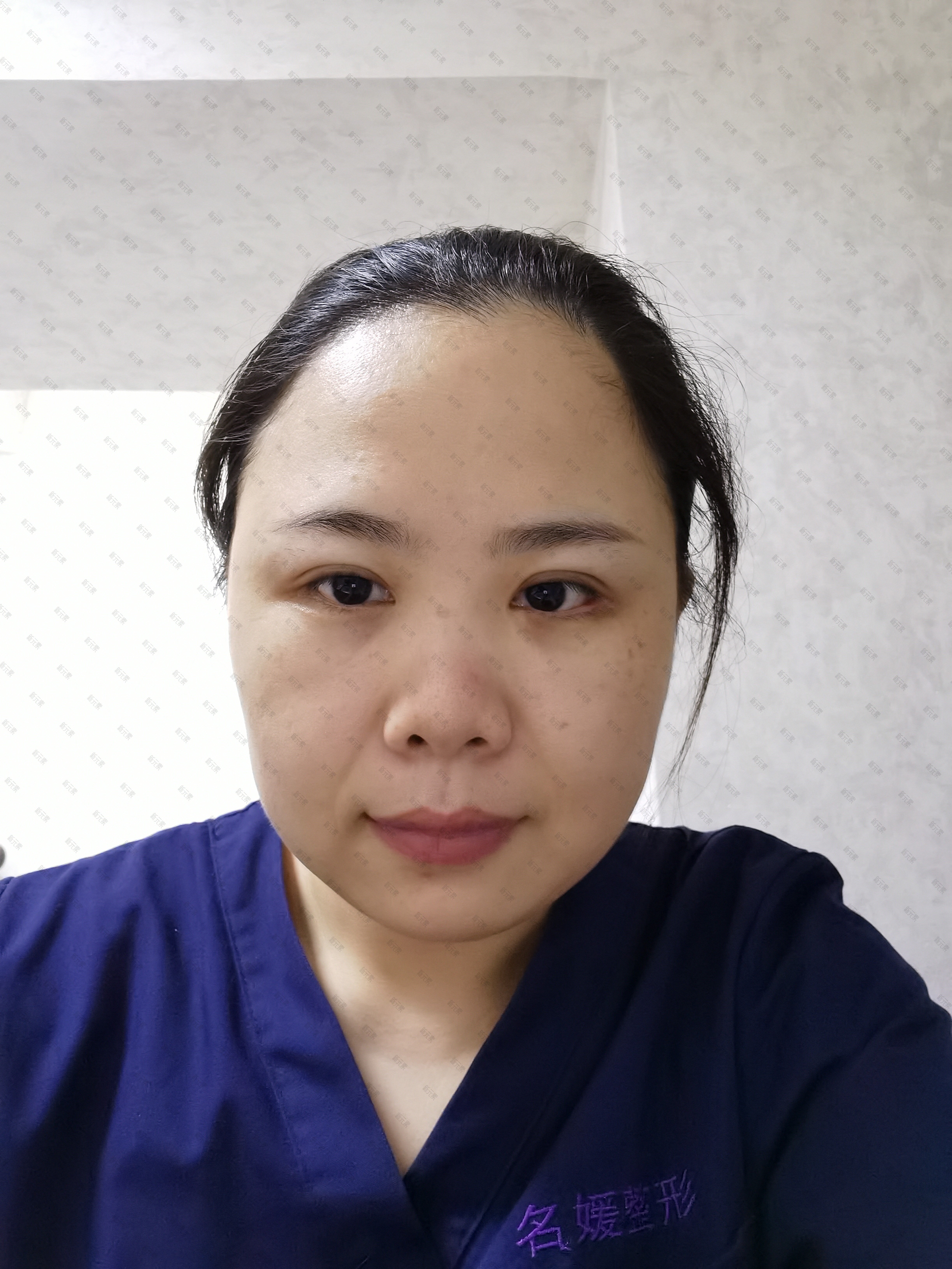 湛江开发区名媛医学美容杜春晓