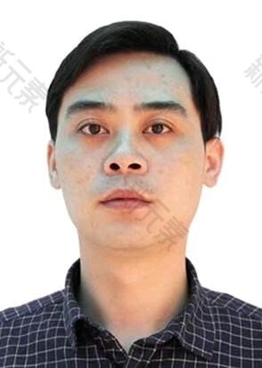 连云港市俏脸整形张凤林