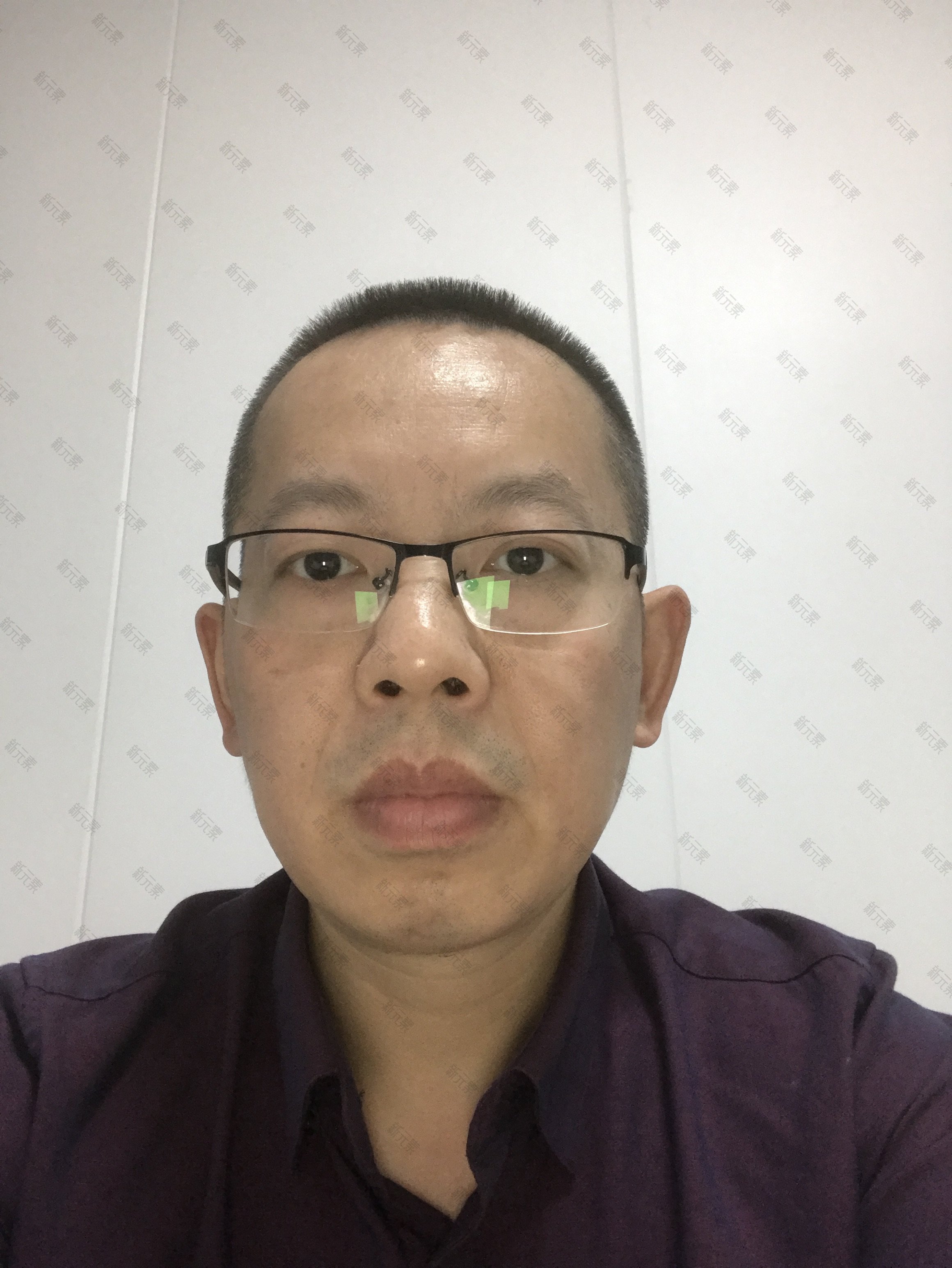 新氧医生咨询团王锋