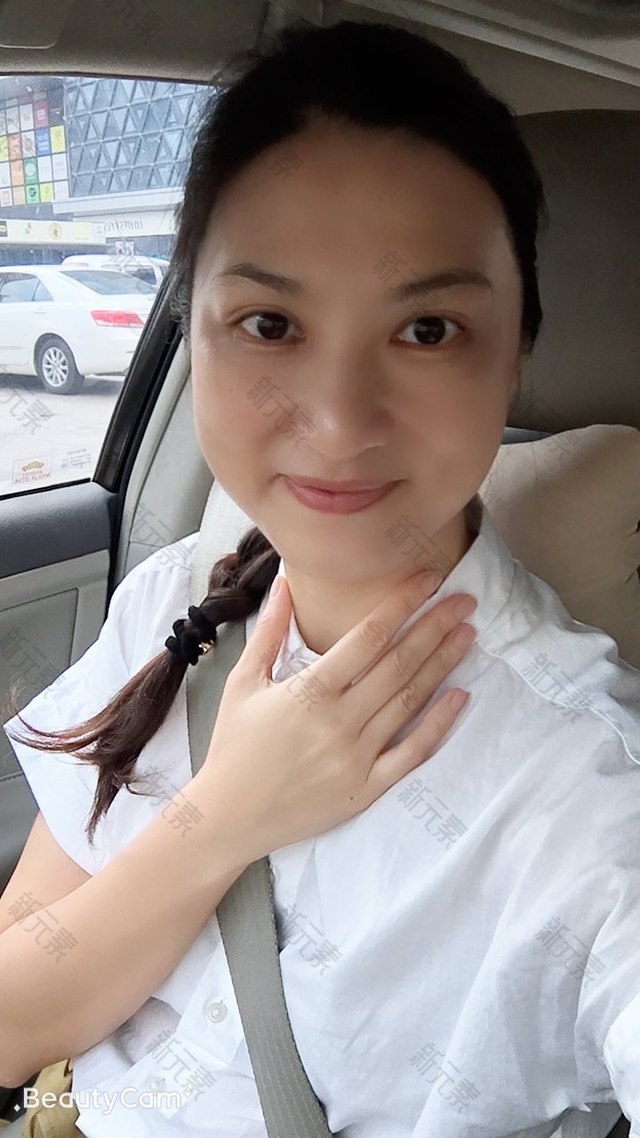 新氧医生咨询团黄绮梨