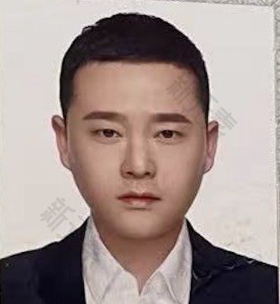 沈阳善英口腔李哲俊